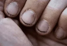nails.webp