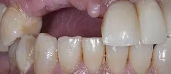 OIP (22).webp