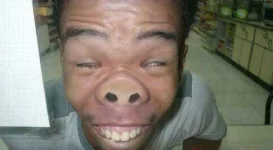 ugly-face-of-funny-man-600x330.webp