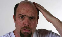Bald.webp