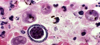 acanthamoeba-banner.webp