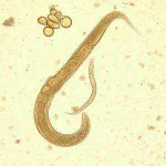 s_stercoralis_adult_larva_bam2.webp
