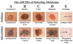 skin-cancer.webp skin-cancer.webp