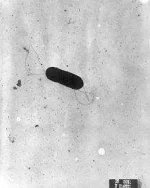 220px-Listeria_monocytogenes_PHIL_2287_lores.webp