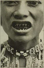 Bagobo-women-teeth-sharpening-and-blackening1.webp