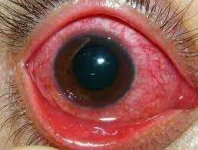 images.webp