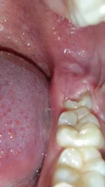 IMG_20200209_123539.webp