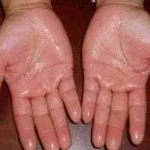 pasma-+-health-myths-+-philippines.webp