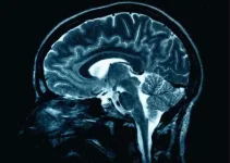 lack-of-oxygen-can-result-in-brain-damage.webp lack-of-oxygen-can-result-in-brain-damage.webp