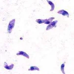 Toxoplasma_gondii_tachy.webp