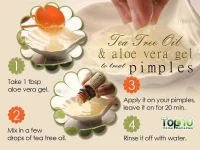 Acne-Tea-Tree-oil-Aloe-vera-gel-600x450.webp Acne-Tea-Tree-oil-Aloe-vera-gel-600x450.webp