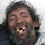 Weird-Teeth-Man-Funny-Smile-Picture.webp