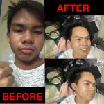 BEFORE.webp BEFORE.webp
