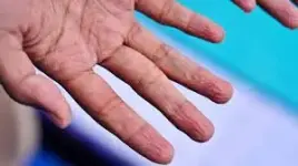 1000009416.webp 1000009416.webp