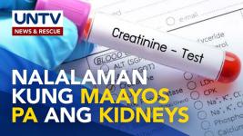 Ano ang Serum Creatinine Test at paano ito nakatutulong sa ating bato? | Now You Know