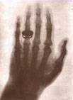 Hand.webp