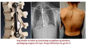 Bakal sa likod.jpg Bakal sa likod.jpg