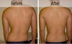 before.after.jpg before.after.jpg