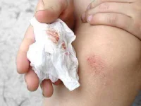 10-black-pepper-healing-cuts-sl.webp