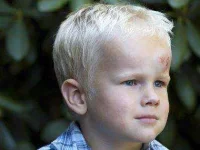 13-things-plastic-surgeons-wont-tell-you-sl2.webp