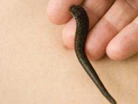 13-things-plastic-surgeons-wont-tell-you-sl4.webp