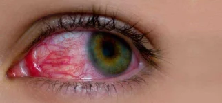 20-Effective-Home-Remedies-For-Sore-Eyes1.webp 20-Effective-Home-Remedies-For-Sore-Eyes1.webp