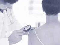 16-cancer-signs-skin-cancer-sl.webp