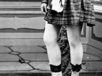 weird-phobias-knees.webp weird-phobias-knees.webp