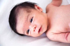 09-newborns-are-hairy.webp