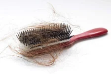 06-hair-falling-out-thyroid-problem.webp