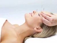 acupuncture-1024x768.webp acupuncture-1024x768.webp