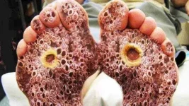 a6739ce2e137c280bc4154efba3a0f5--trypophobia-weird.webp