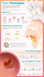 monkeypox-explainer-infographic.jpg monkeypox-explainer-infographic.jpg