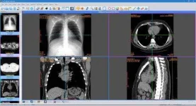 Sante DICOM Editor 3D 4.9.4 + ρá†ch.webp