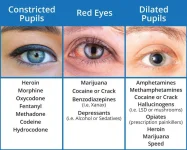 Pupil-Dialation-Drug-Chart.webp