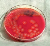 Bacillus_cereus02.jpeg Bacillus_cereus02.jpeg