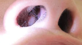 1296x728_Polype_Nasal.webp 1296x728_Polype_Nasal.webp