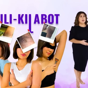 Ilang gumamit ng underarm whitening cream, nagkasugat-sugat ang kilikili! | Kapuso Mo, Jessica Soho