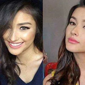 Liza Soberano